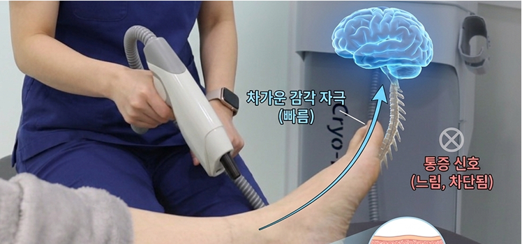 반사적 근이완